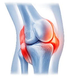 Lcl Injuries